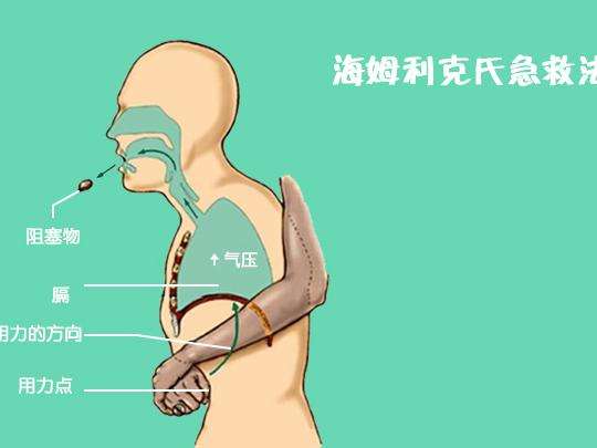 吞咽異物可致死 兩種救護措施要牢記